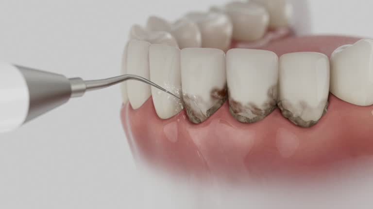 Trusted Dental Crowns And Bridges service in Pearson, GA - Dentist Open Now